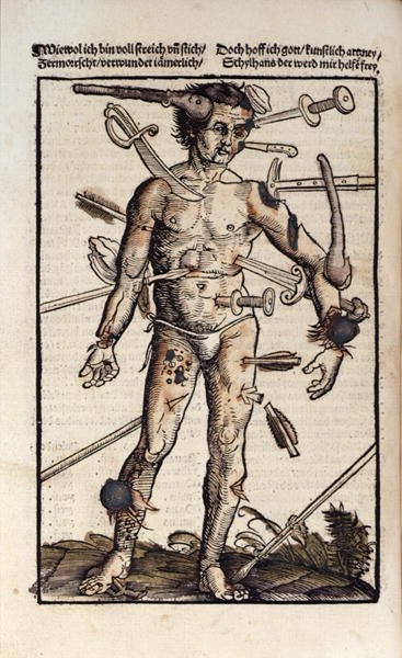 XVIIIv The Wound Man, from the Feldtbuch der Wundartzney by Hans von Gersdorff, 1517